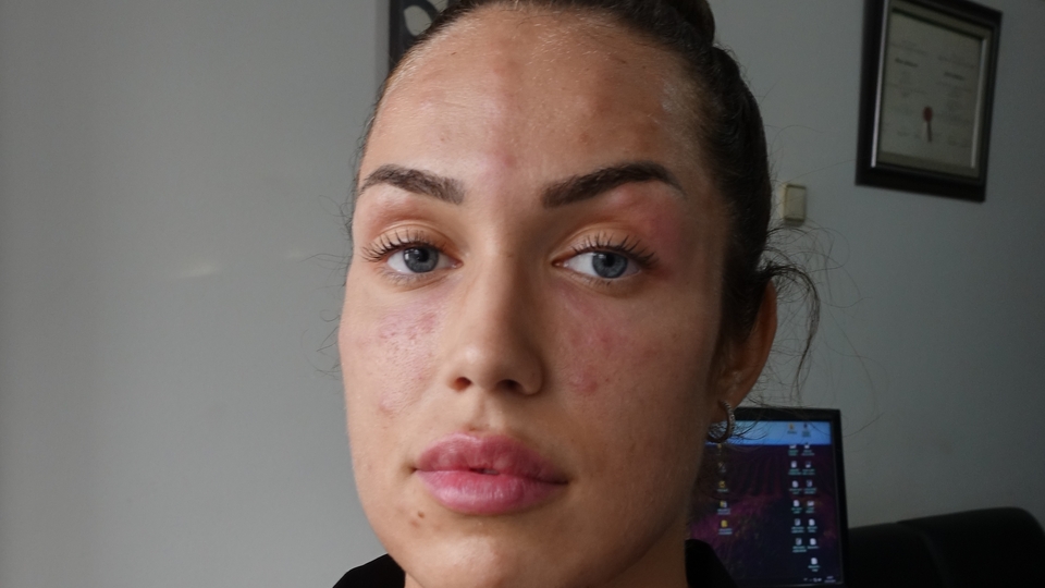 'Gençlik aşısı' bu hale getirdi!