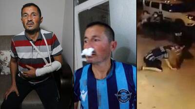 İşitme engelliye akılalmaz dayak!