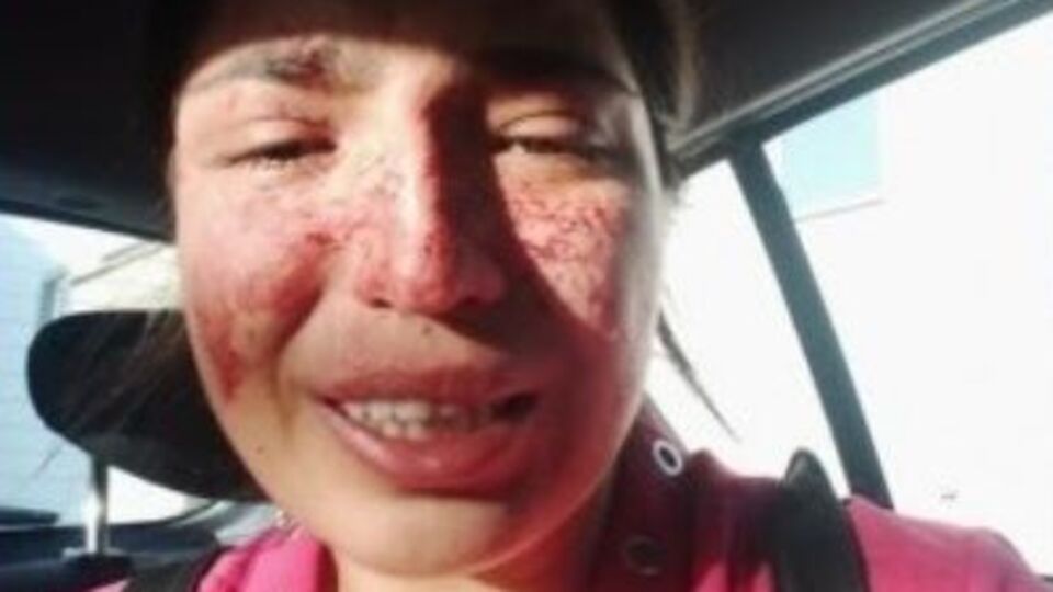 Eşinden şiddet gören Sibel, sesini böyle duyurdu