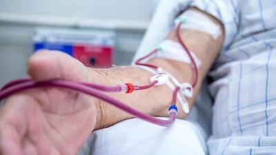 Böbrek yetmezliği tedavisinde diyaliz yöntemi