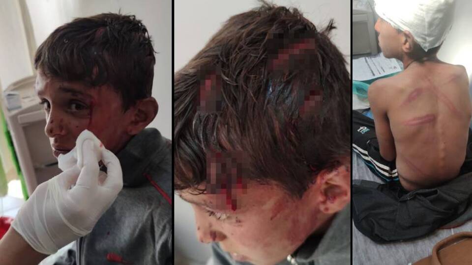 10 yaşındaki çocuğa korkunç dayak!