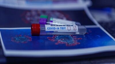 Covid-19 test sonucu öğrenme ekranı!