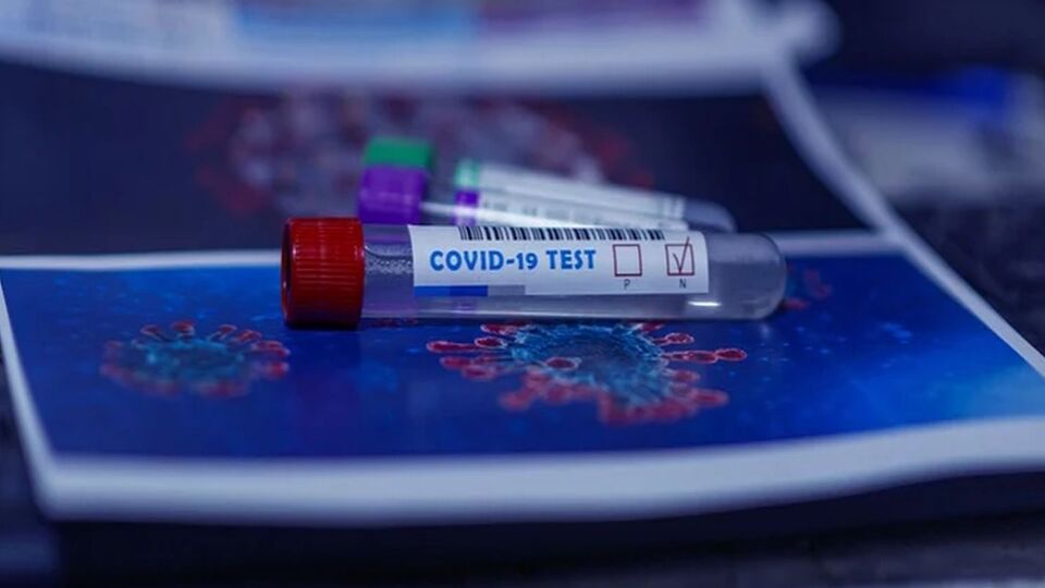 Covid-19 test sonucu öğrenme ekranı!