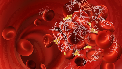 Covid-19 damarların içinde işte bunu yapıyor...