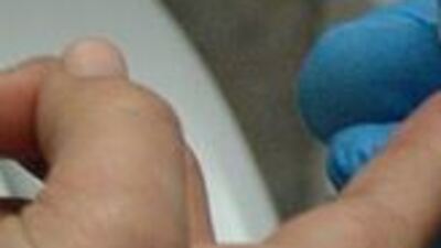 Diyabetli her 2 yetişkinden 1'i hastalığını bilmiyor