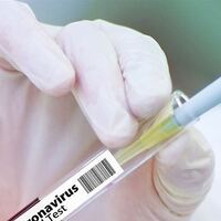 Yeni koronavirüs aşısı bulundu