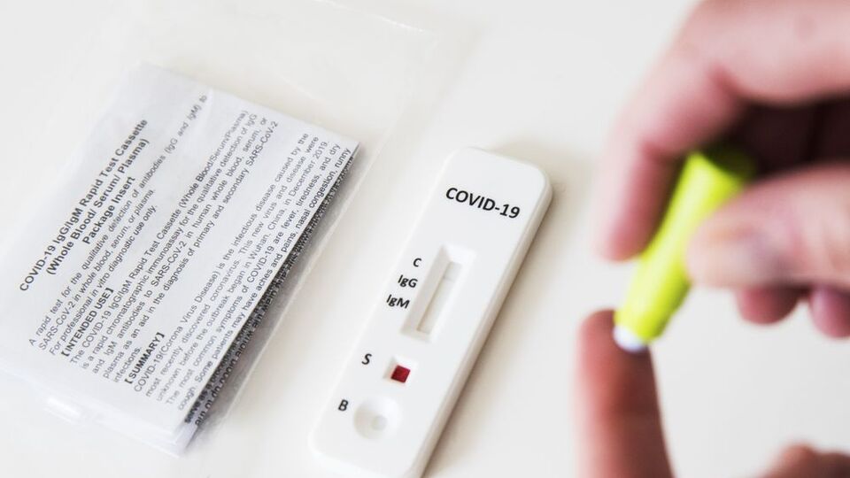 Covid-19 test sonucu nasıl öğrenilir?