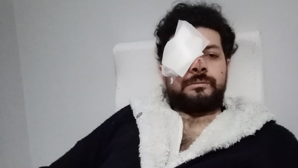 Gözünü kaybeden genç şarkıcı dehşet anlarını anlattı!