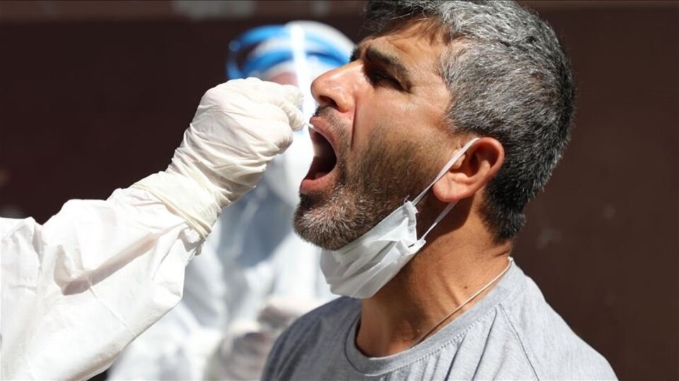 Covid-19 test ücreti ne kadar?