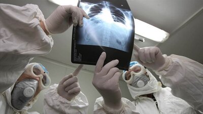 Sars virüsü nedir?