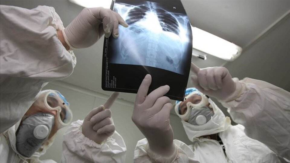 Sars virüsü nedir?