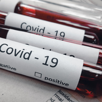 Hangi kan grubunda koronavirüsten ölüm riski daha yüksek? Bilim insanları açıkladı