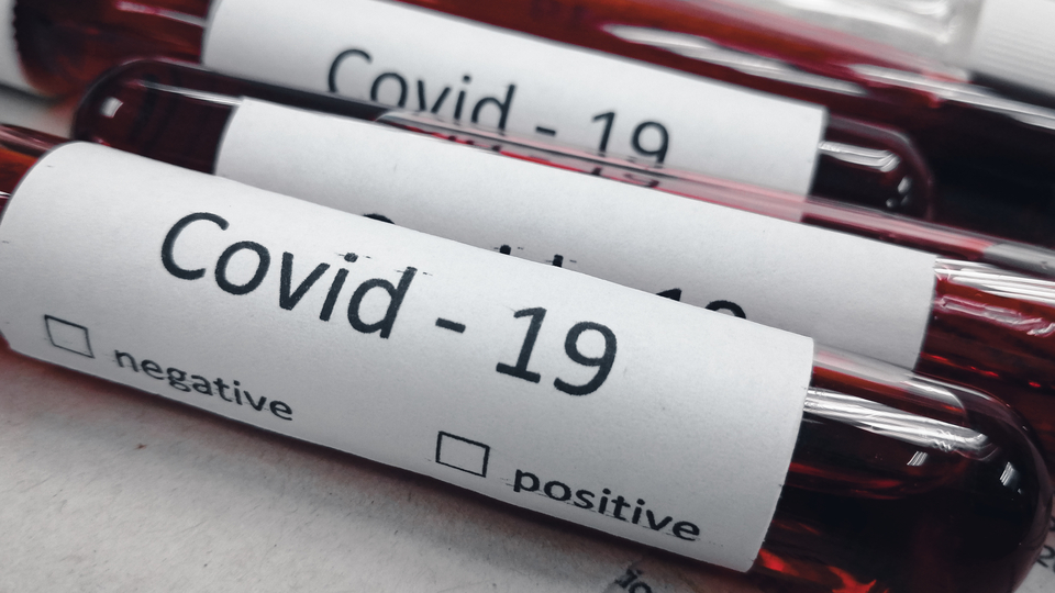 Hangi kan grubunda koronavirüsten ölüm riski daha yüksek? Bilim insanları açıkladı