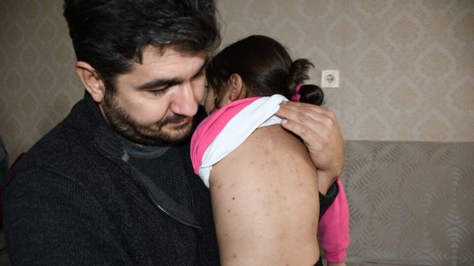 Berra'yı 100 saçmayla yaralamışlardı! İşte verilen ceza!