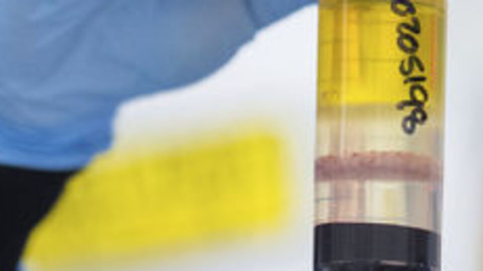 ABD´de koronavirüs aşısı önceliği haftaya belli olacak