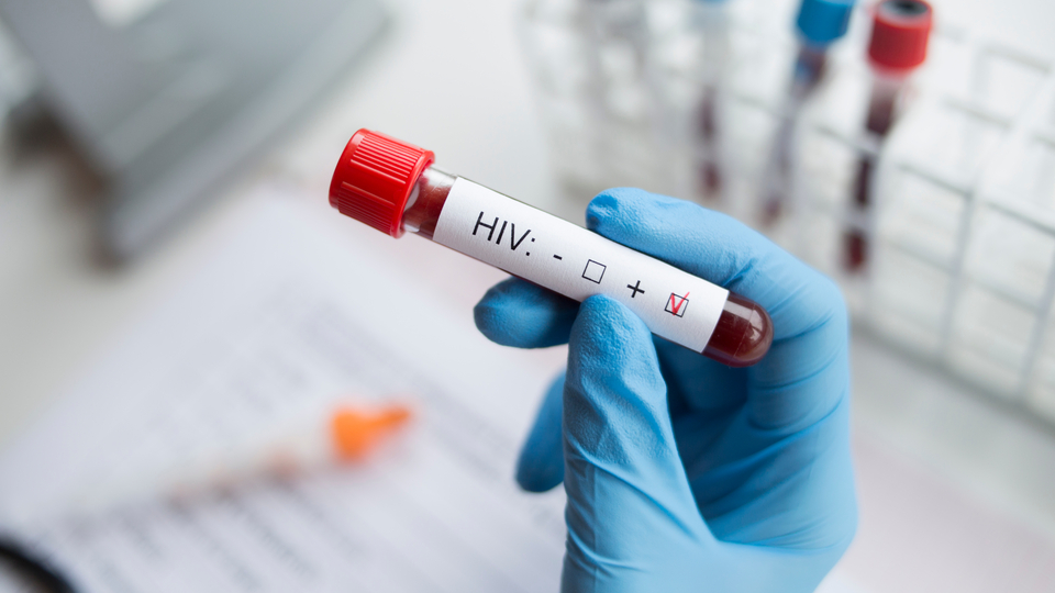 HIV artık ölümcül değil kronik bir hastalık!