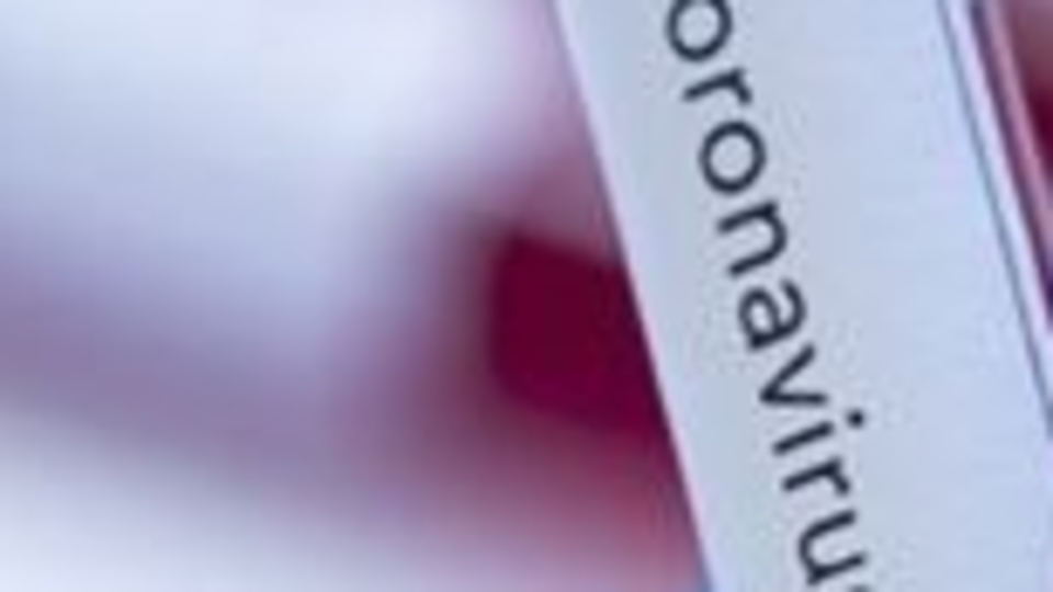 İl Sağlık Müdürü Özdemir'in testi pozitif çıktı