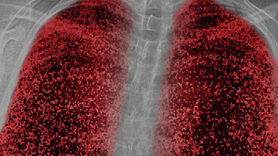 Korkutan hasar! Geleneksel yöntemlerle tespit edilemiyor