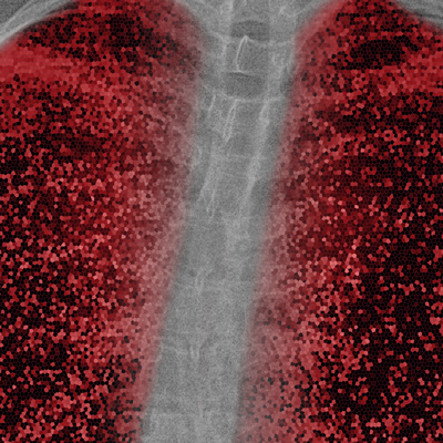 Korkutan hasar! Geleneksel yöntemlerle tespit edilemiyor