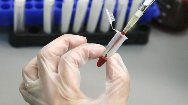 UNICEF'den korkutan rakamlar! 22 bin çocuk AIDS'e yakalandı
