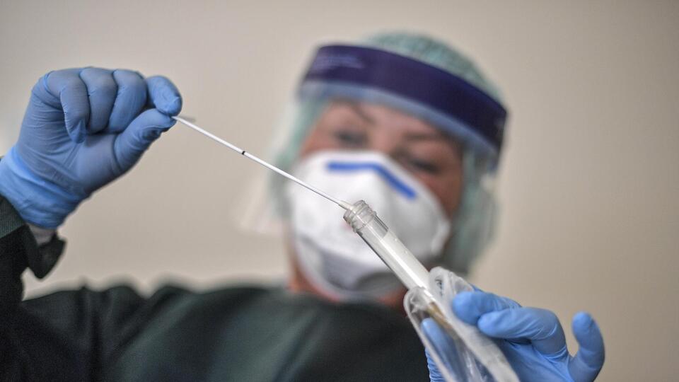 Covid-19 test sonucu nasıl öğrenilir?