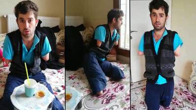 Protez kol için yardım bekliyor