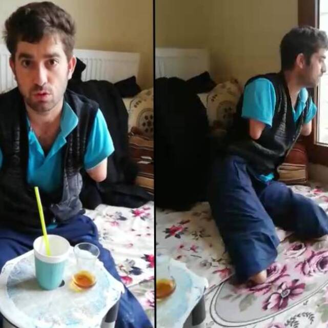 Protez kol için yardım bekliyor