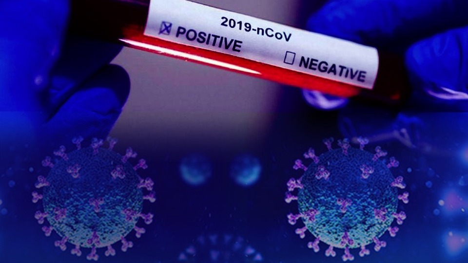 Korkutan açıklama! Covid-19 testi pozitif biri ilaçlarını kullanmazsa...