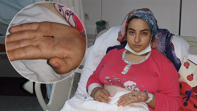 1 yaşında yutmuştu... 17 yıl sonra kurtuldu