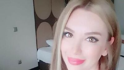 Botoks sonrası hayatını kaybetmişti! İşte Kübra'nın ölüm nedeni!