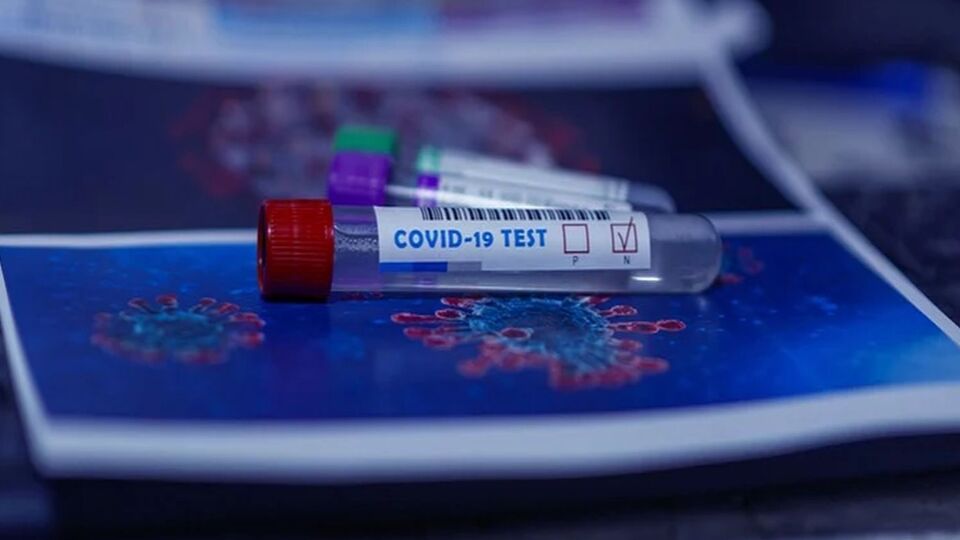 Covid-19 test sonucu nasıl öğrenilir?