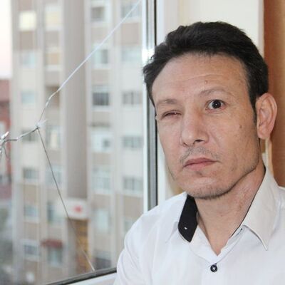 Pencereden baktı, kör oldu!