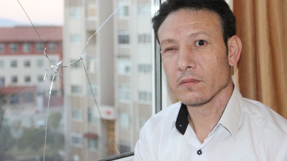 Pencereden baktı, kör oldu!