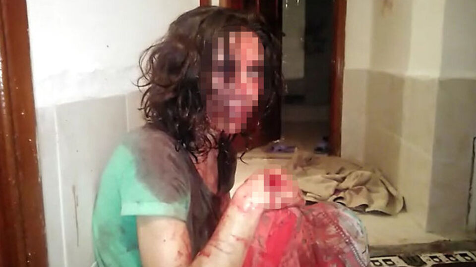 Eşini öldüresiye dövdü! "Kendisi yapmıştır" dedi!