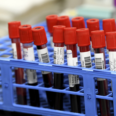 Mutasyona uğrayan yeni koronavirüs hakkında neler biliniyor?