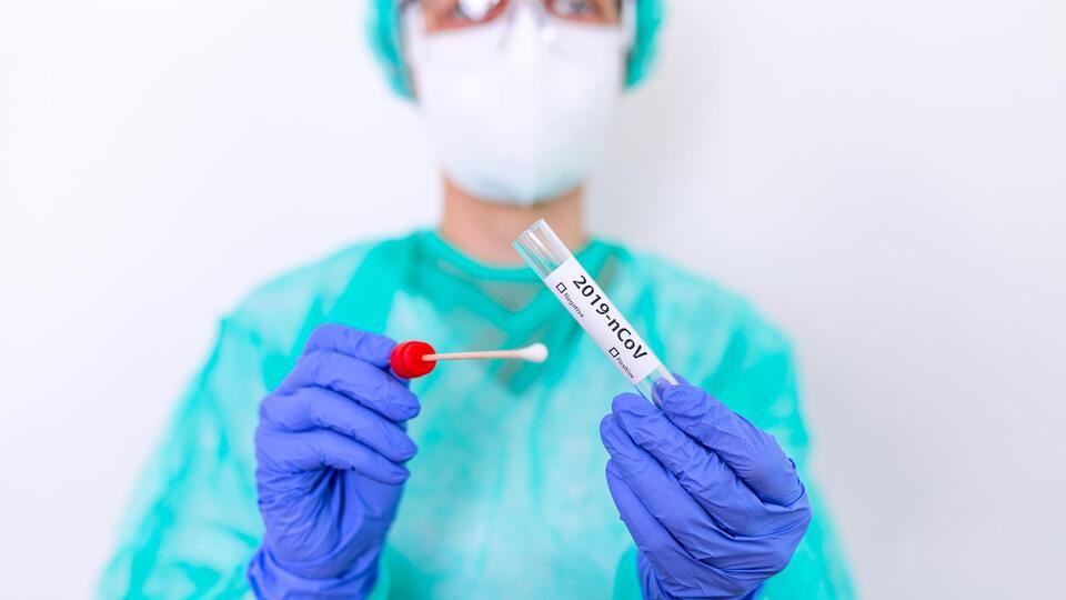 Covid-19 test sonucu nasıl öğrenilir?