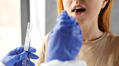 Covid-19 test sonucu nasıl öğrenilir?