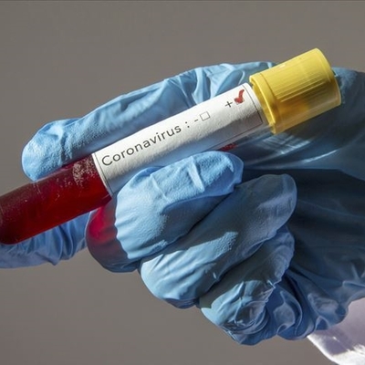 Araştırma ortaya koydu! İşte Covid-19'a karşı bağışıklık süresi