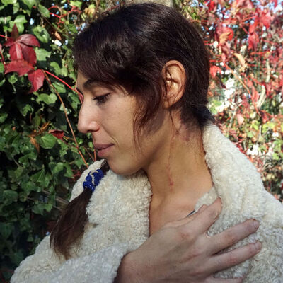 Eski eşinin boğazını kesti: Yanlış anlaşıldım