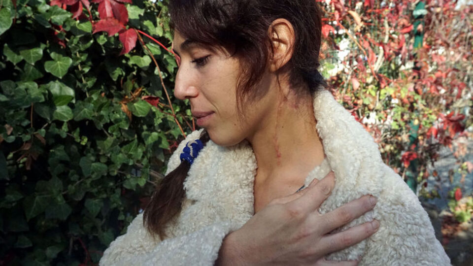 Eski eşinin boğazını kesti: Yanlış anlaşıldım