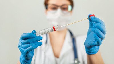 Covid-19 test sonucu nereden, nasıl öğrenilir?