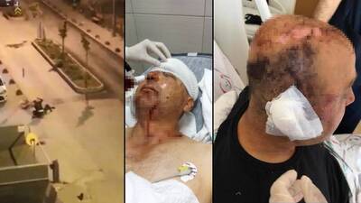 Dehşet anları! Polisin kafasını parçaladı