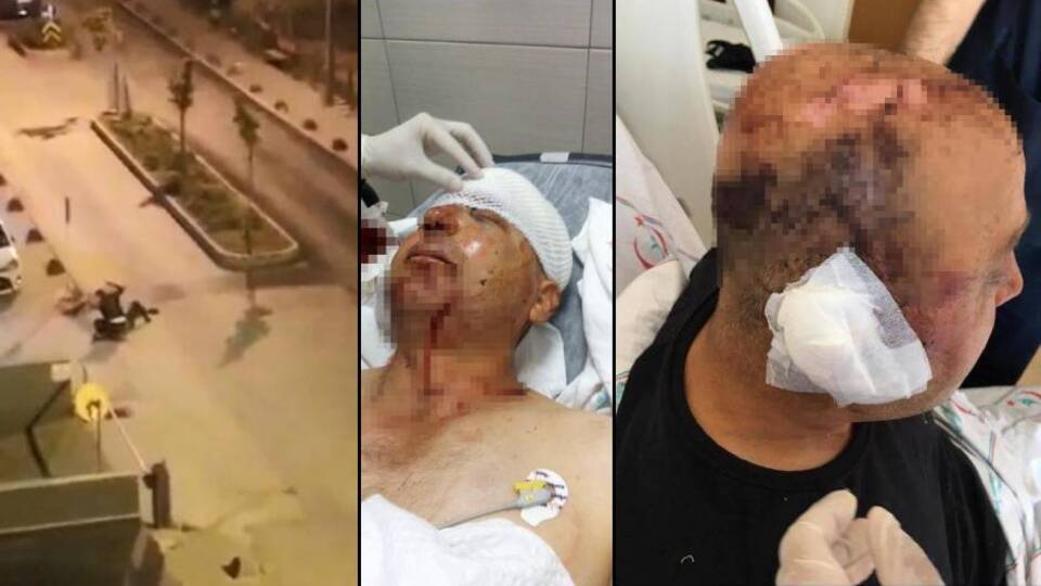 Dehşet anları! Polisin kafasını parçaladı