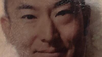 Japon turist saç ekimi sonrası öldü!