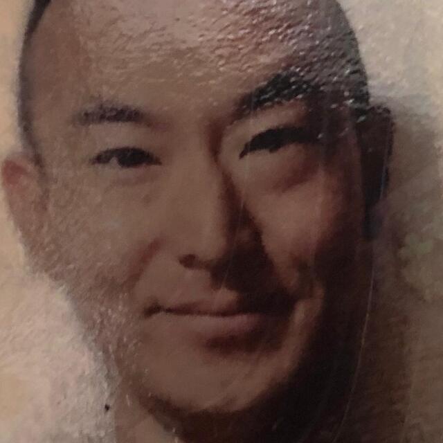 Japon turist saç ekimi sonrası öldü!