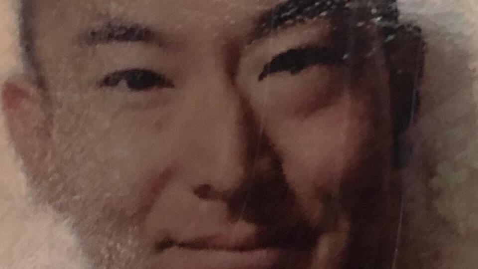 Japon turist saç ekimi sonrası öldü!