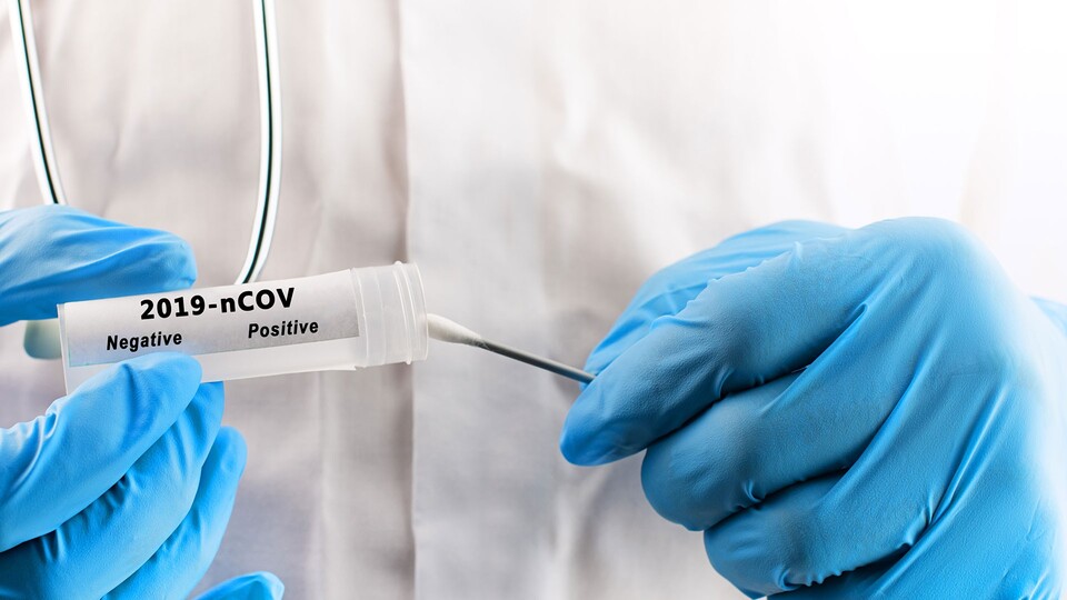 Covid-19 test sonucu nereden, nasıl öğrenilir?