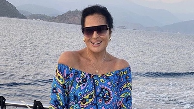 Estetik değil Cushing Sendromu bitişi