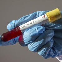 Korona yüzünden 12 günde 10 kilo verdi