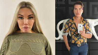 75 kez ameliyat olan Alves: Kendim olmaya karar verdim